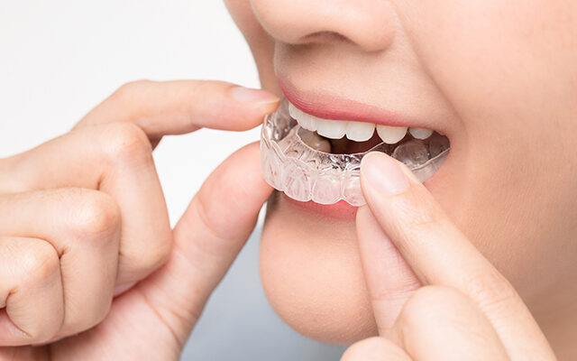 Stay on Track, See Results Sooner: Smart Ways to Maximize Your Invisalign Progress